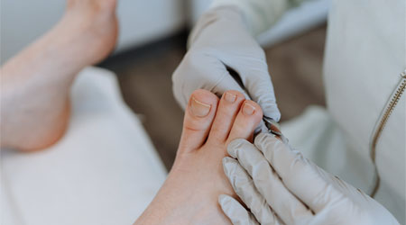 Diabetic Foot Care