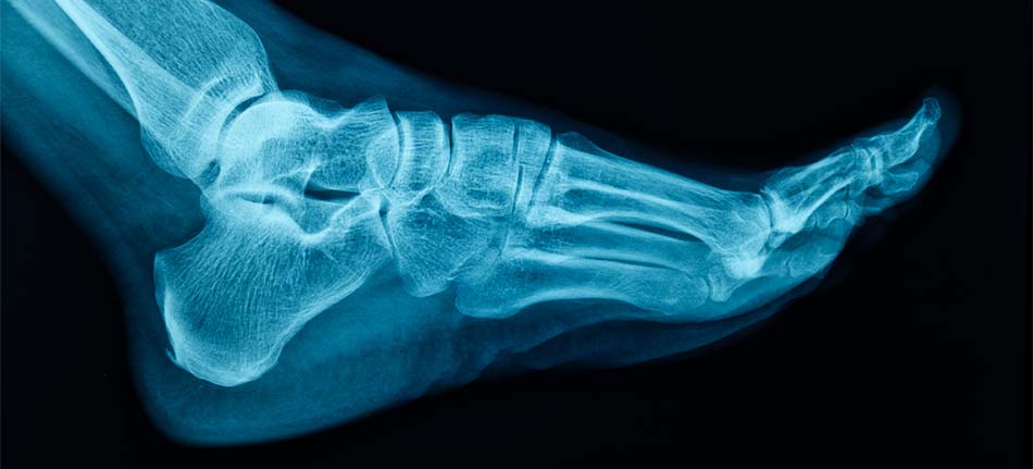 Digital X-Rays in Sarasota, FL