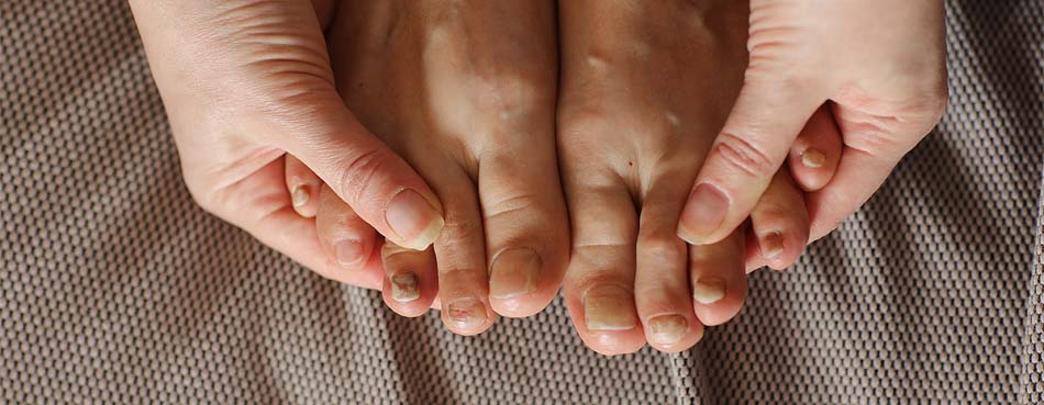 Toenail Conditions in Sarasota, FL